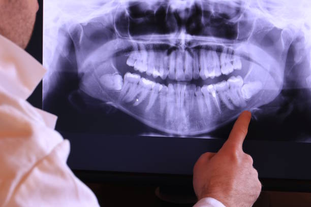 Best Emergency Gum Treatment in Kuna, ID